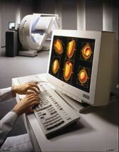 Nuclear Medicine Image 